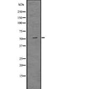 Western blot analysis of MMP12 using Jurkat whole  lysates.