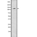 Western blot analysis of ABCG1 using HT29 whole  lysates.