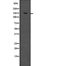 Western blot analysis of LDLR using HeLa whole  lysates.