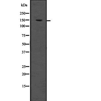 Western blot analysis of LDLR using HeLa whole  lysates.