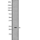 Western blot analysis of CRADD using HepG2 whole  lysates.