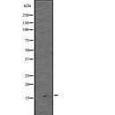 Western blot analysis of ARPC5 using HuvEc whole  lysates.