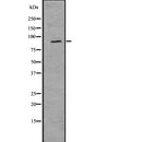DF7702 staining  293 cells by IF/ICC. The sample were fixed with PFA and permeabilized in 0.1% Triton X-100,then blocked in 10% serum for 45 minutes at 25¡ãC. The primary antibody was diluted at 1/200 and incubated with the sample for 1 hour at 37¡ãC. An  Alexa Fluor 594 conjugated goat anti-rabbit IgG (H+L) antibody(Cat.