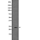 Western blot analysis of HE4 using HepG2 whole  lysates.
