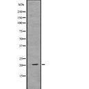 DF7705 staining  Hela cells by IF/ICC. The sample were fixed with PFA and permeabilized in 0.1% Triton X-100,then blocked in 10% serum for 45 minutes at 25¡ãC. The primary antibody was diluted at 1/200 and incubated with the sample for 1 hour at 37¡ãC. An  Alexa Fluor 594 conjugated goat anti-rabbit IgG (H+L) antibody(Cat.