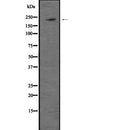 Western blot analysis of Dicer using RAW264.7 whole  lysates