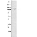 DF7709 staining Hela by IF/ICC. The sample were fixed with PFA and permeabilized in 0.1% Triton X-100,then blocked in 10% serum for 45 minutes at 25¡ãC. The primary antibody was diluted at 1/200 and incubated with the sample for 1 hour at 37¡ãC. An  Alexa Fluor 594 conjugated goat anti-rabbit IgG (H+L) Ab, diluted at 1/600, was used as the secondary antibod