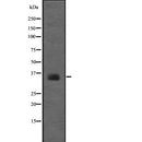 Western blot analysis of 67kDa Laminin Receptor  using COS7 whole  lysates.