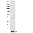 DF7715 at 1/100 staining Human pancreas tissue by IHC-P. The sample was formaldehyde fixed and a heat mediated antigen retrieval step in citrate buffer was performed. The sample was then blocked and incubated with the antibody for 1.5 hours at 22¡ãC. An HRP conjugated goat anti-rabbit antibody was used as the secondary