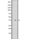 Western blot analysis of Aquaporin 7 using Jurkat whole  lysates.