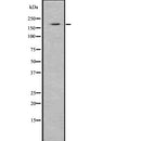 Western blot analysis of C5 using NIH-3T3 whole  lysates.
