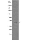 DF7720 at 1/100 staining Mouse colon tissue by IHC-P. The sample was formaldehyde fixed and a heat mediated antigen retrieval step in citrate buffer was performed. The sample was then blocked and incubated with the antibody for 1.5 hours at 22¡ãC. An HRP conjugated goat anti-rabbit antibody was used as the secondary