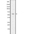 Western blot analysis of IRG1 using LOVO whole  lysates.