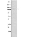 Western blot analysis of NEDD4-2 using K562 whole  lysates.