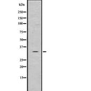 Western blot analysis of ILP2 using K562 whole  lysates.