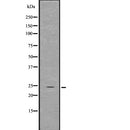 Western blot analysis of GDNF using NIH-3T3 whole  lysates.