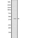 Western blot analysis of CXCR1 using K562 whole  lysates.