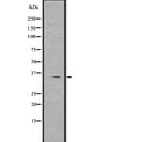 Western blot analysis of Spermidine using Jurkat whole  lysates.
