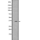Western blot analysis of PPT1 using Jurkat whole  lysates.