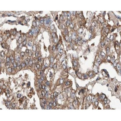 AF0588 at 1/100 staining human stomach tissue sections by IHC-P. The tissue was formaldehyde fixed and a heat mediated antigen retrieval step in citrate buffer was performed. The tissue was then blocked and incubated with the antibody for 1.5 hours at 22¡ãC. An HRP conjugated goat anti-rabbit antibody was used as the secondary