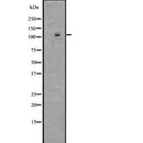 Western blot analysis of LGR4 using LOVO whole  lysates.