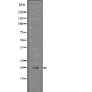 DF7741 at 1/100 staining Human Melanoma tissue by IHC-P. The sample was formaldehyde fixed and a heat mediated antigen retrieval step in citrate buffer was performed. The sample was then blocked and incubated with the antibody for 1.5 hours at 22¡ãC. An HRP conjugated goat anti-rabbit antibody was used as the secondary
