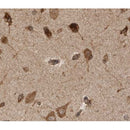 Western blot analysis of extracts from rat brain, using PINK1 Antibody.