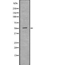DF7743 at 1/100 staining Human Head and neck cancer tissue by IHC-P. The sample was formaldehyde fixed and a heat mediated antigen retrieval step in citrate buffer was performed. The sample was then blocked and incubated with the antibody for 1.5 hours at 22¡ãC. An HRP conjugated goat anti-rabbit antibody was used as the secondary