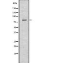Western blot analysis of Choline Acetyltransferase using HuvEc whole  lysates.