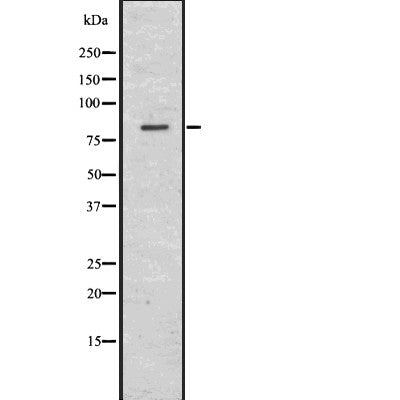Western blot analysis of Choline Acetyltransferase using HuvEc whole  lysates.