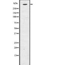 Western blot analysis of CENP-E using K562 whole  lysates.