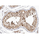 AF0712 staining Hela by IF/ICC. The sample were fixed with PFA and permeabilized in 0.1% Triton X-100,then blocked in 10% serum for 45 minutes at 25¡ãC. The primary antibody was diluted at 1/200 and incubated with the sample for 1 hour at 37¡ãC. An  Alexa Fluor 594 conjugated goat anti-rabbit IgG (H+L) Ab, diluted at 1/600, was used as the secondary antibod