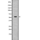 Western blot analysis of Shh using COLO205 whole  lysates.