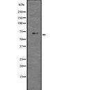 Western blot analysis of GLIS1 using HT29 whole  lysates.
