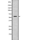 Western blot analysis of GLP1R using COLO205 whole  lysates.