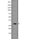 Western blot analysis of CD134 using COLO205 whole  lysates.
