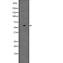 Western blot analysis of ZKSCAN3 using Jurkat whole  lysates.