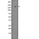 Western blot analysis of extracts from mouse brain, using Nestin  Antibody. Lane 1 was treated with the antigen-specific peptide.