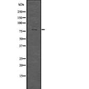Western blot analysis of extracts from mouse heart and rat lung, using PRMT7 Antibody.