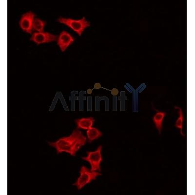AF0516 staining Hela by IF/ICC. The sample were fixed with PFA and permeabilized in 0.1% Triton X-100,then blocked in 10% serum for 45 minutes at 25¡ãC. The primary antibody was diluted at 1/200 and incubated with the sample for 1 hour at 37¡ãC. An  Alexa Fluor 594 conjugated goat anti-rabbit IgG (H+L) Ab, diluted at 1/600, was used as the secondary antibod