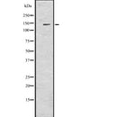 Western blot analysis of Sall4 using HuvEc whole  lysates.
