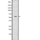 DF7759 staining HepG2 by IF/ICC. The sample were fixed with PFA and permeabilized in 0.1% Triton X-100,then blocked in 10% serum for 45 minutes at 25¡ãC. The primary antibody was diluted at 1/200 and incubated with the sample for 1 hour at 37¡ãC. An  Alexa Fluor 594 conjugated goat anti-rabbit IgG (H+L) Ab, diluted at 1/600, was used as the secondary antibod