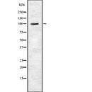 DF7762 staining Hela by IF/ICC. The sample were fixed with PFA and permeabilized in 0.1% Triton X-100,then blocked in 10% serum for 45 minutes at 25¡ãC. The primary antibody was diluted at 1/200 and incubated with the sample for 1 hour at 37¡ãC. An  Alexa Fluor 594 conjugated goat anti-rabbit IgG (H+L) Ab, diluted at 1/600, was used as the secondary antibod