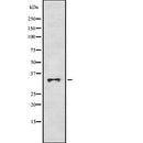 Western blot analysis of IGFBP2 using Jurkat whole  lysates.