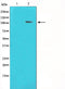 Western blot analysis on HeLa cell lysate using HDAC7 Antibody,The lane on the left is treated with the antigen-specific peptide.