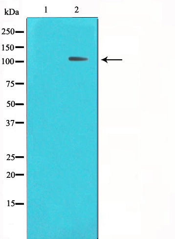 Western blot analysis on HeLa cell lysate using HDAC7 Antibody,The lane on the left is treated with the antigen-specific peptide.