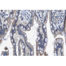 AF0180 at 1/100 staining human colon carcinoma tissue sections by IHC-P. The tissue was formaldehyde fixed and a heat mediated antigen retrieval step in citrate buffer was performed. The tissue was then blocked and incubated with the antibody for 1.5 hours at 22¡ãC. An HRP conjugated goat anti-rabbit antibody was used as the secondary