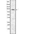 DF7769 staining HepG2 by IF/ICC. The sample were fixed with PFA and permeabilized in 0.1% Triton X-100,then blocked in 10% serum for 45 minutes at 25¡ãC. The primary antibody was diluted at 1/200 and incubated with the sample for 1 hour at 37¡ãC. An  Alexa Fluor 594 conjugated goat anti-rabbit IgG (H+L) Ab, diluted at 1/600, was used as the secondary antibod