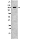 Western blot analysis of CR2 using Jurkat whole  lysates.