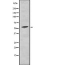 Western blot analysis of Phospho-PKM2 (Tyr105) using COLO205 whole  lysates.